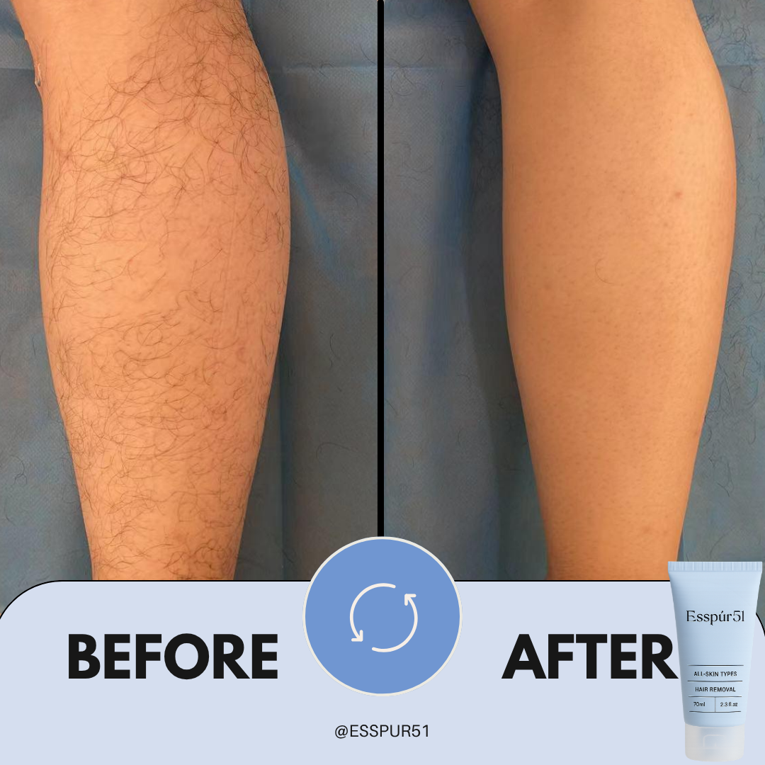 Hairremovalcream
