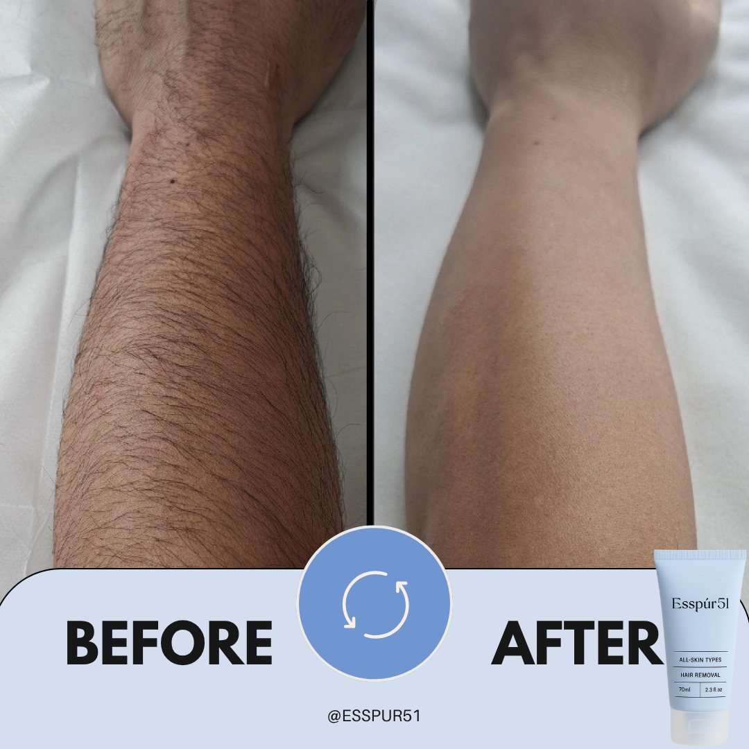 Hairremovalcream