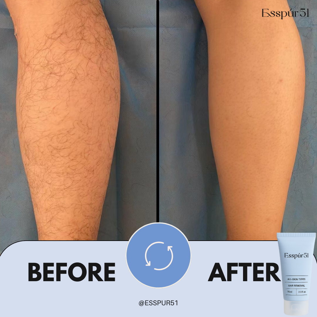 Intimate Hair Removal Cream x1 【Perfect for First Trial】