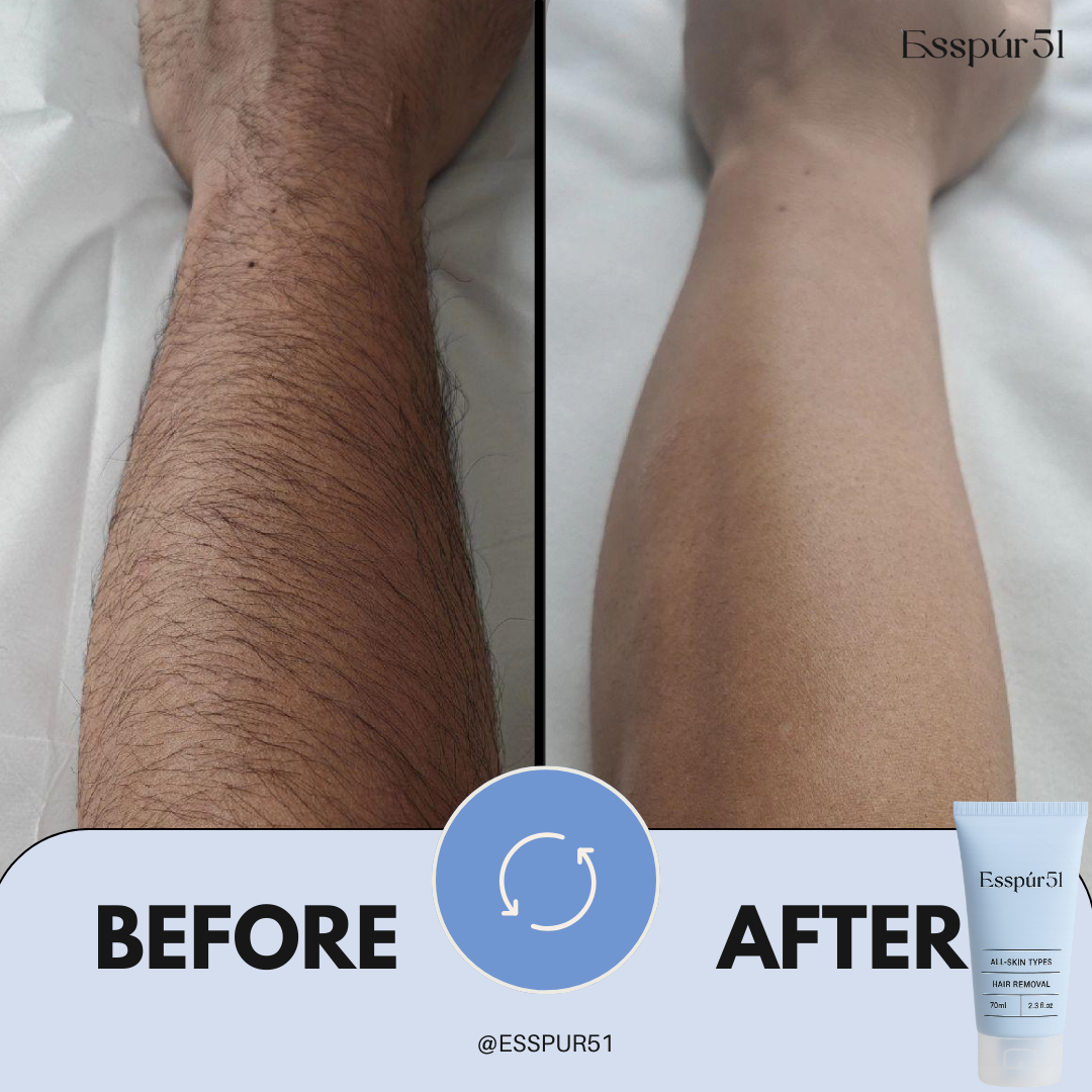 Intimate Hair Removal Cream x1 【Perfect for First Trial】