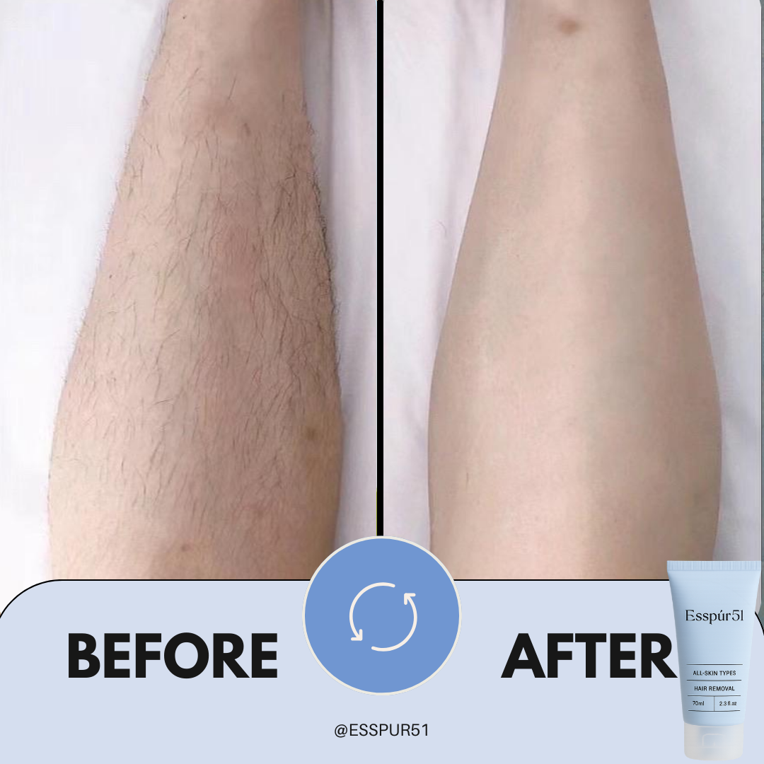 SET C - Removal Cream x3 + Aloe Vera x2