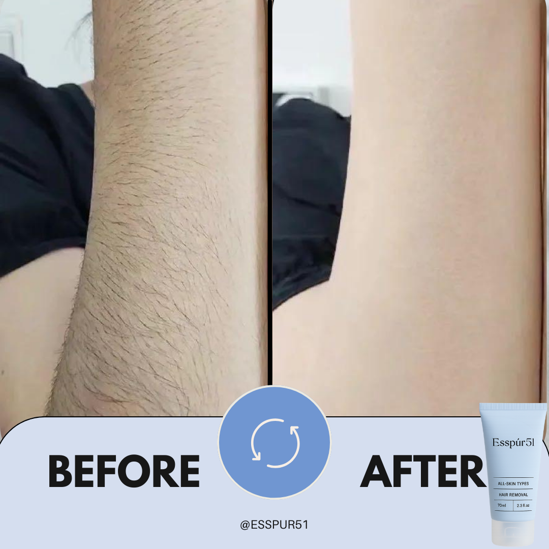 SET C - Removal Cream x3 + Aloe Vera x2